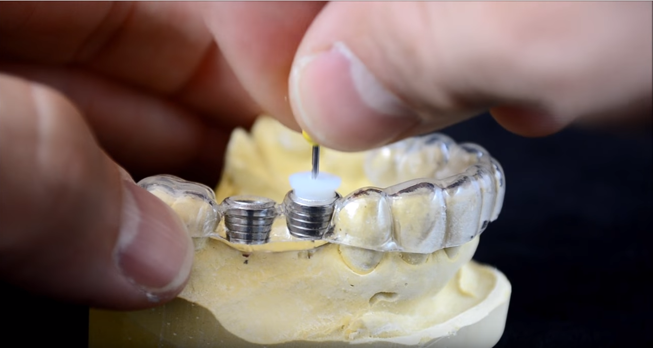 Dental implant surgical guide drilling protocol