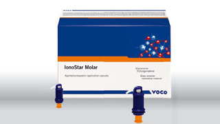 VOCO – Ionostar Molar