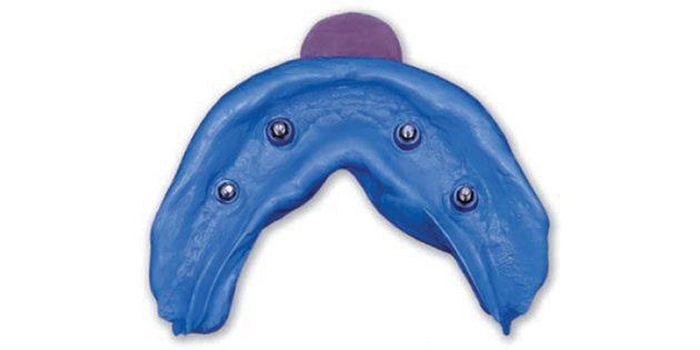 Hydrorise Implant de Zhermack : silicone par addition à hauterigidité, idéal en implantologie