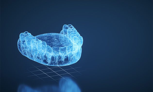 Du nouveau dans l’impression dentaire 3D