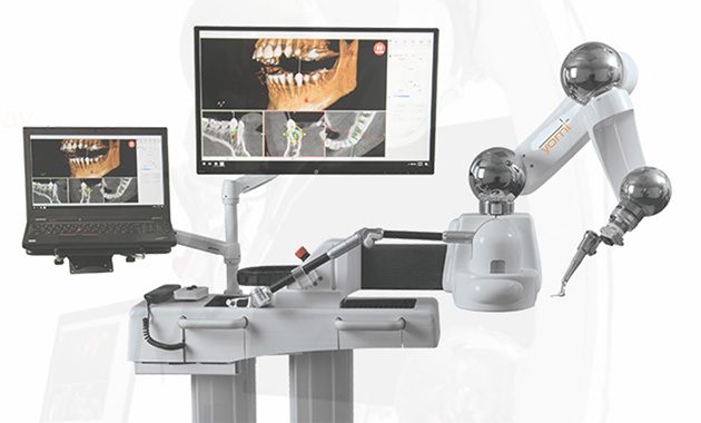 Implantologie : un robot pour assister les dentistes américains