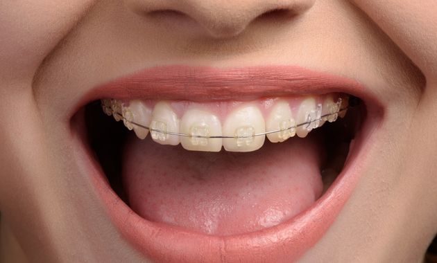 Les biorythmes dentaires permettraient de surveiller la prise de poids chez les ados