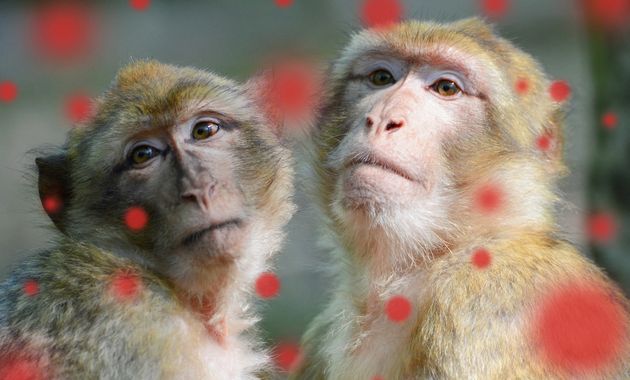 Variole du singe : la détecter au cabinet dentaire