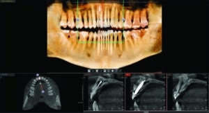 radiographie contrôle
