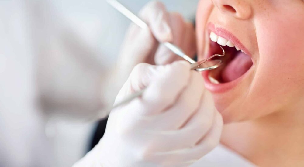 Pour l&rsquo;UFSBD, le dépistage précoce des cancers buccaux est essentiel