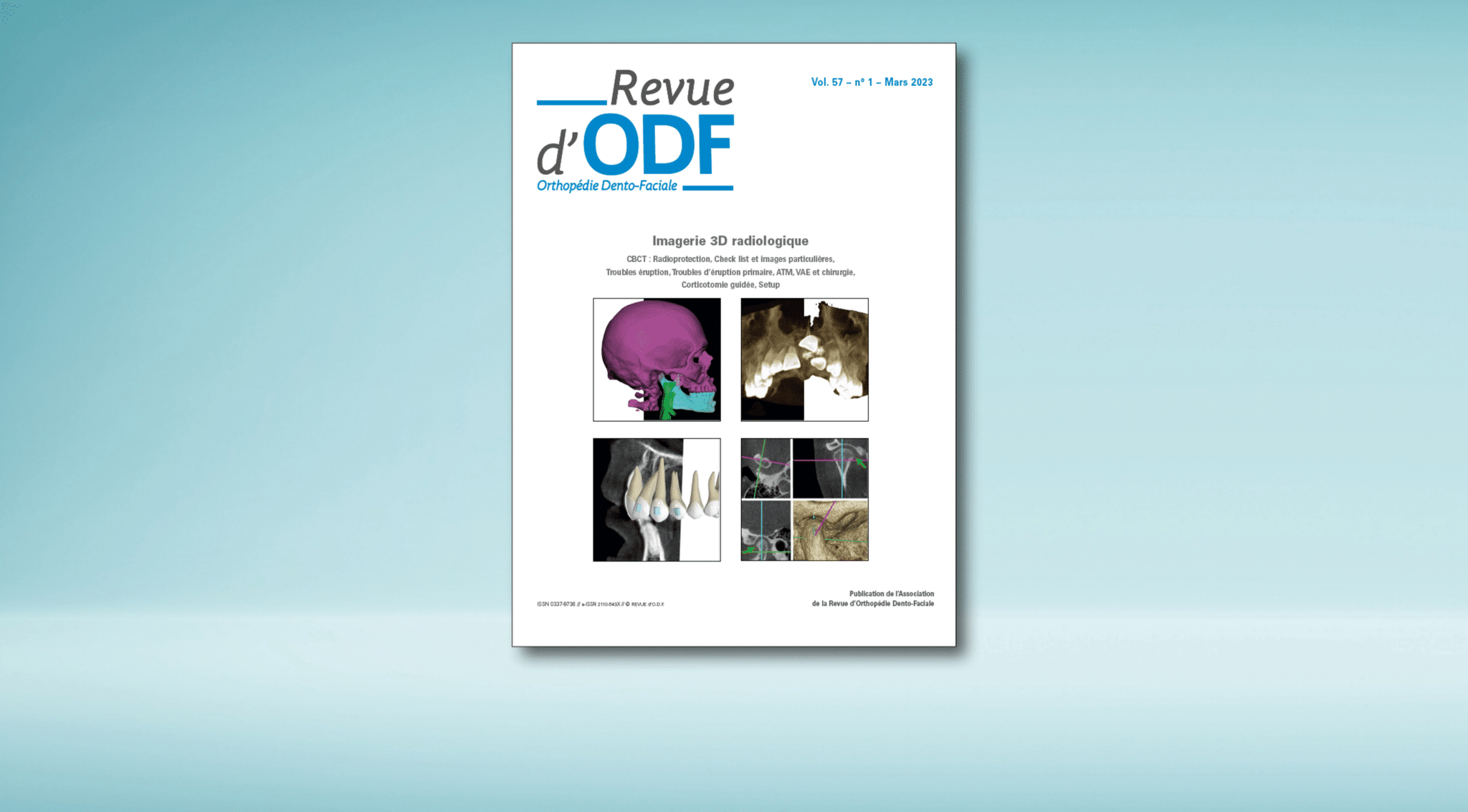 La Revue d’ODF – N°57-1 : Imagerie 3D radiologique