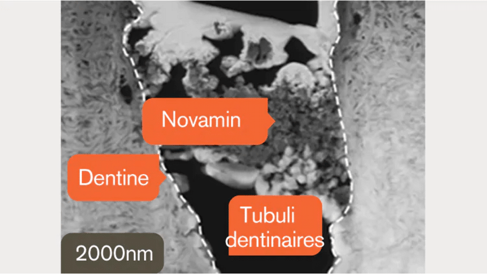 dentinaire