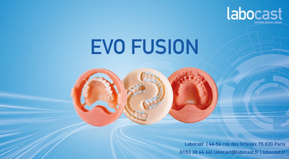 EVO FUSION – Flux numérique pour vos prothèses amovibles complètes !