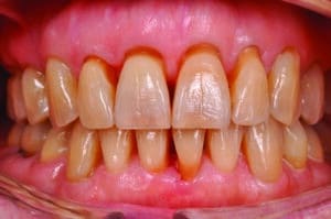 54e39060be34648e39060be341ce39v