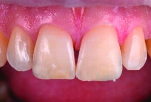 5cf68d7a6644660078d7a664434078v