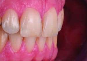 5eafd0bc6644632bfd0bc664406bfdv