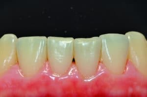 7d316e82be3466c026e82be34e0126v