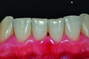 8243fa62be3466643fa62be343a43fv