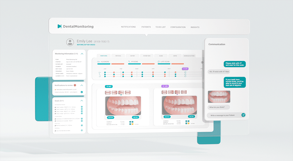 Nouveauté DentalMonitoring