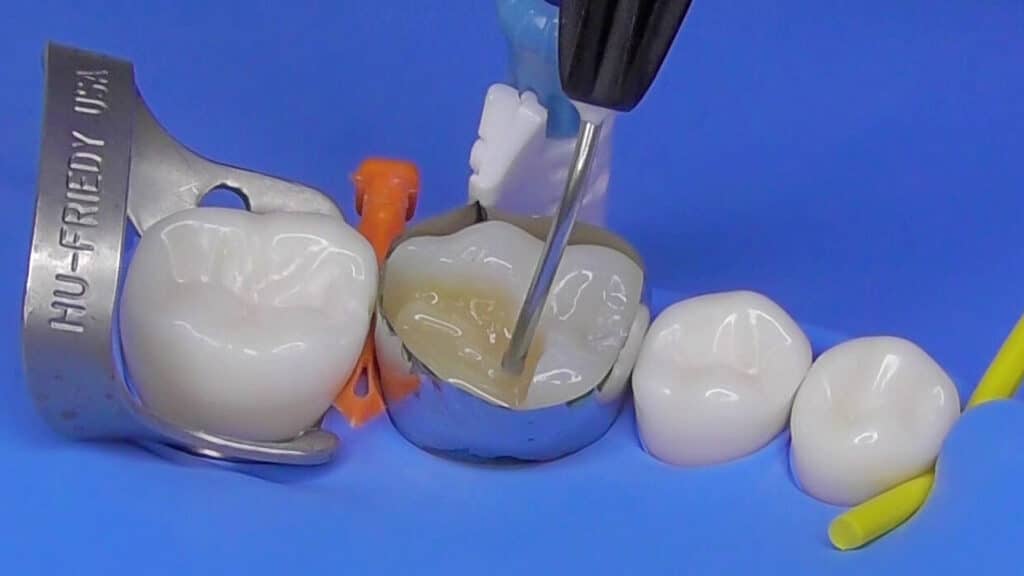 mctpi01