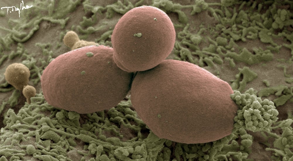 Régénération du microbiote intestinal après antibiothérapie: zoom sur les effets de Saccharomyces boulardii CNCM I-745