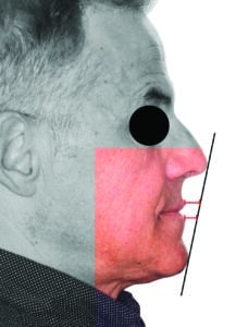 déséquilibre visuel