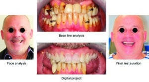 smile design
