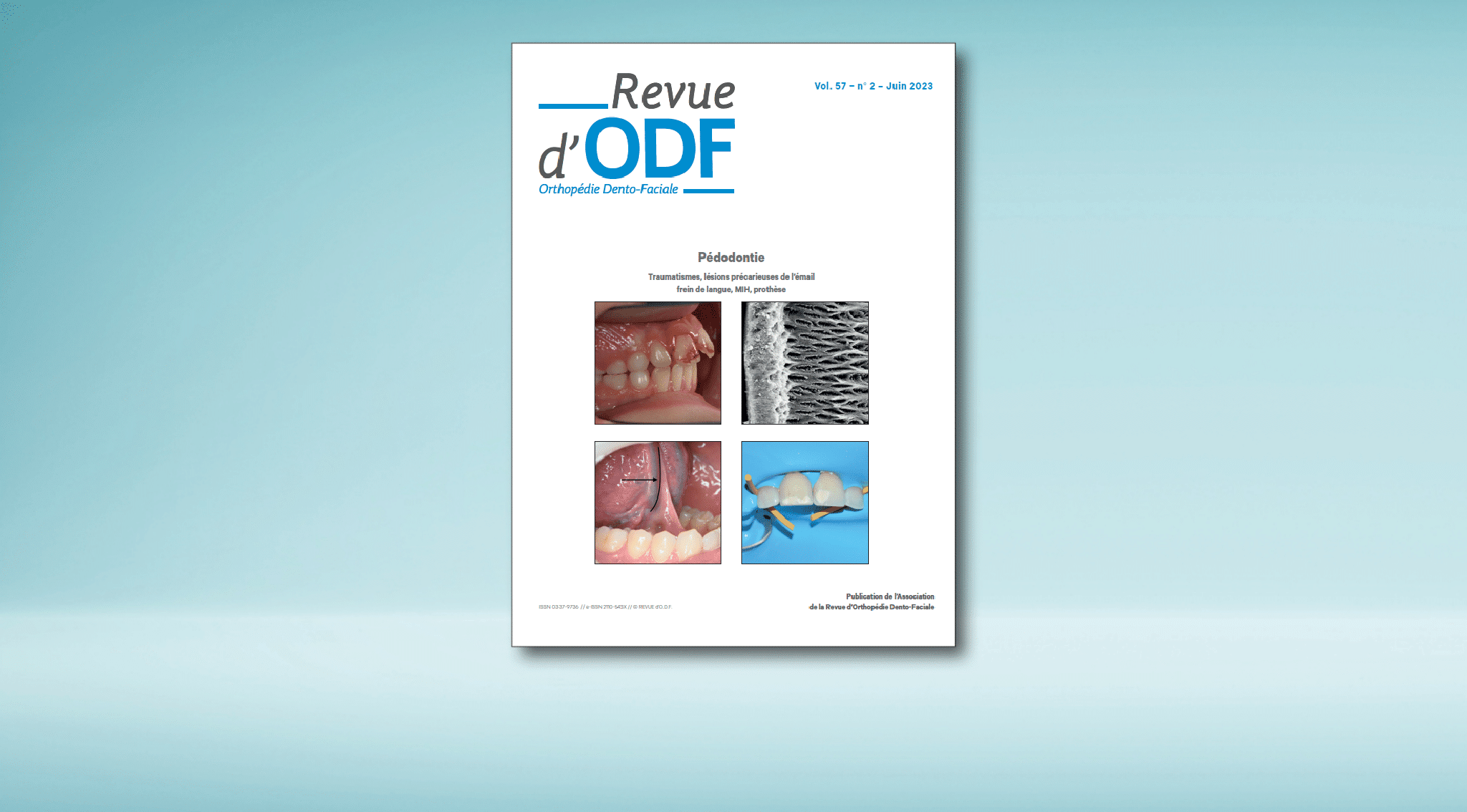 La Revue d’ODF – N°57-2 : Pédodontie