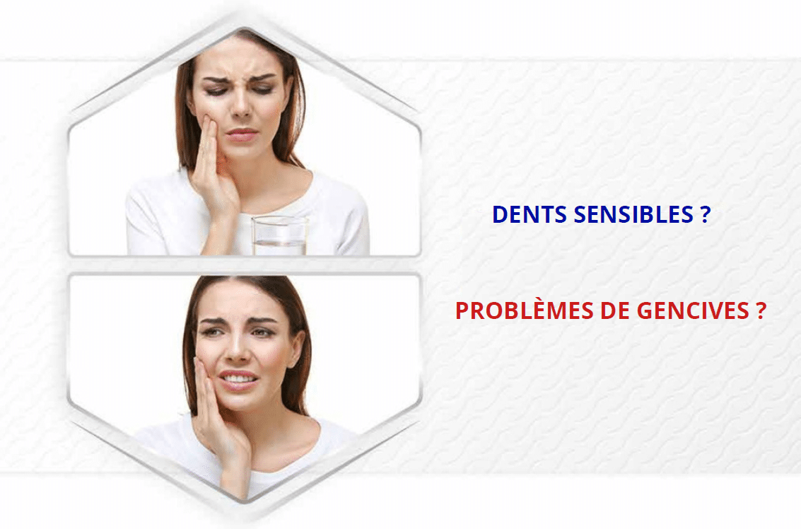 dents sensibles