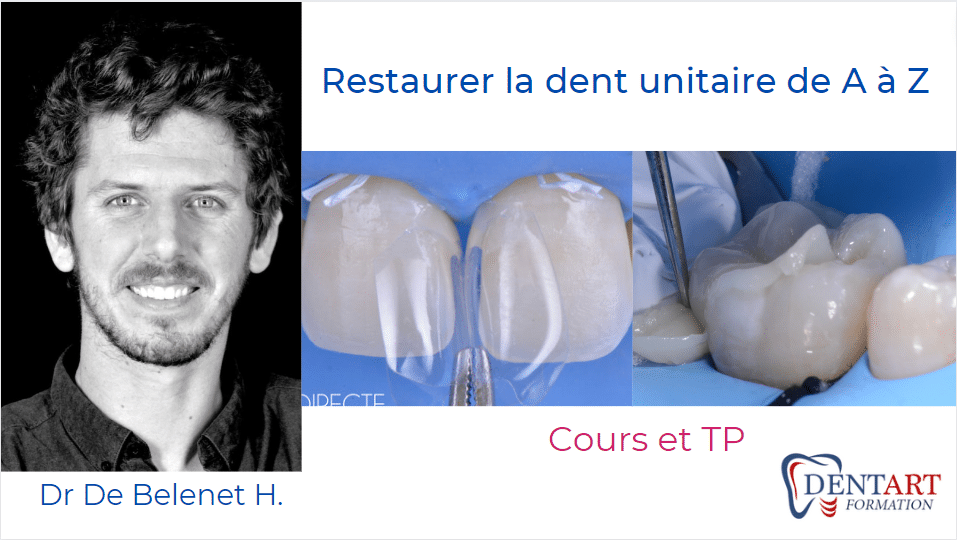 06. restaurer la dent unitaire