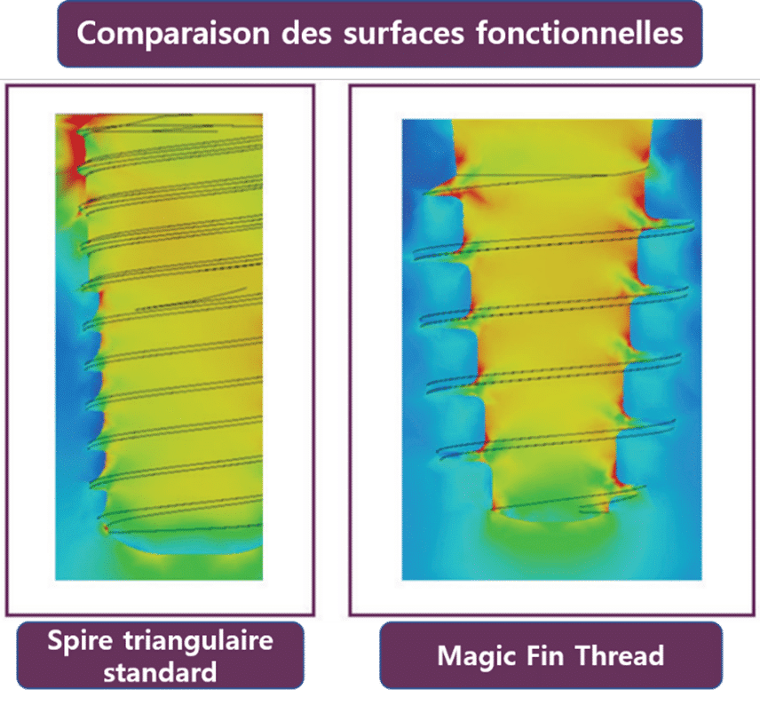 comparaison du système d'implant bone level