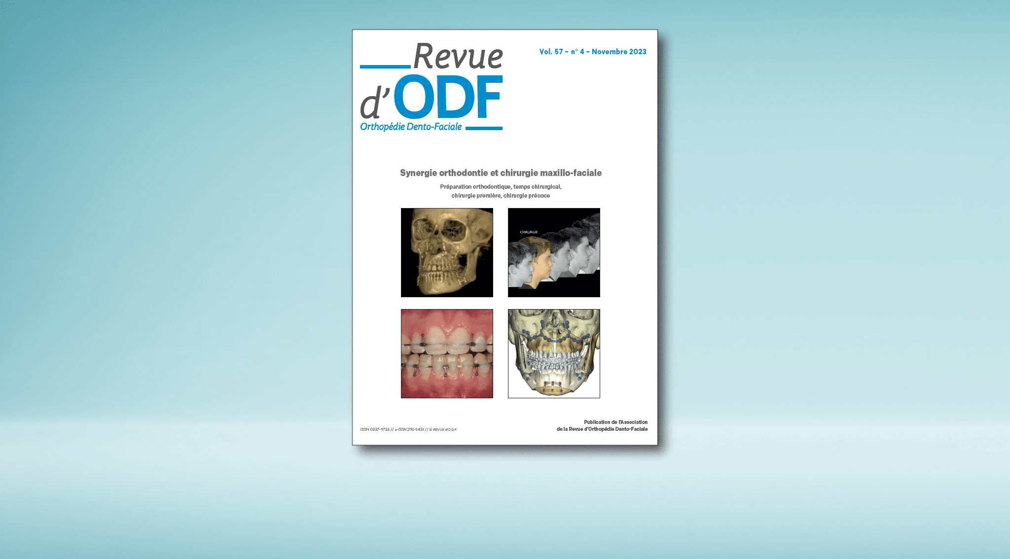 La Revue d’ODF – N°57-4 : Synergie orthodontie et chirurgie maxillo-faciale