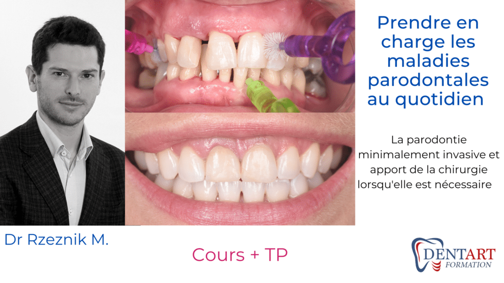 parodontie clinique ok 980x551 1