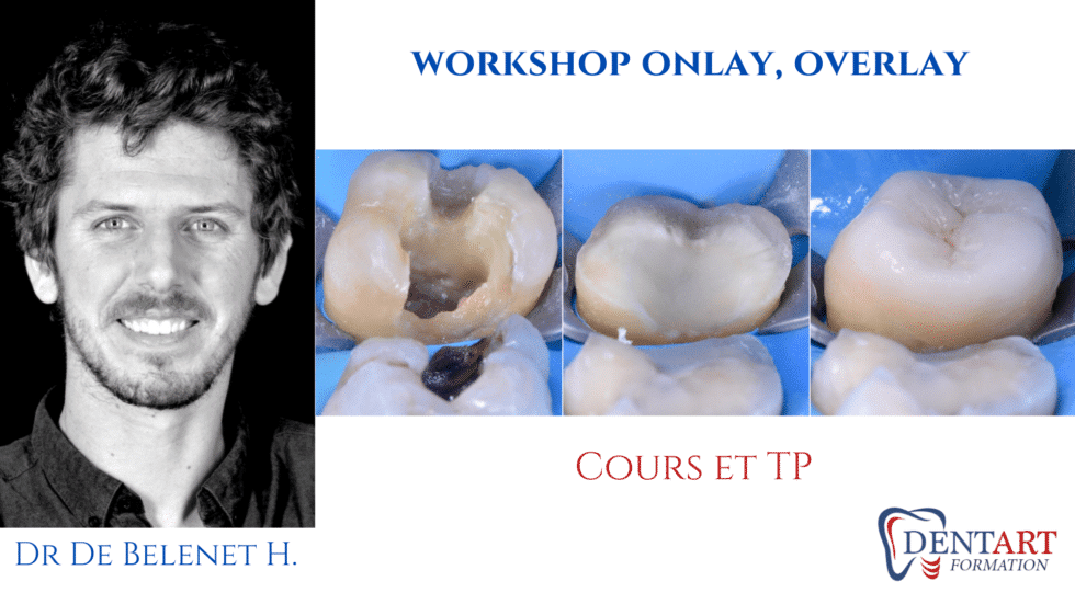 workshop only overlay ok 980x551 1