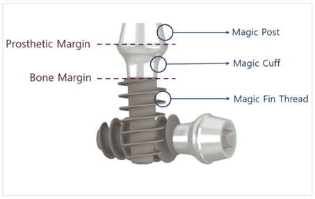 l'implant magicore