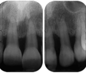 Image radiographique préopératoire
