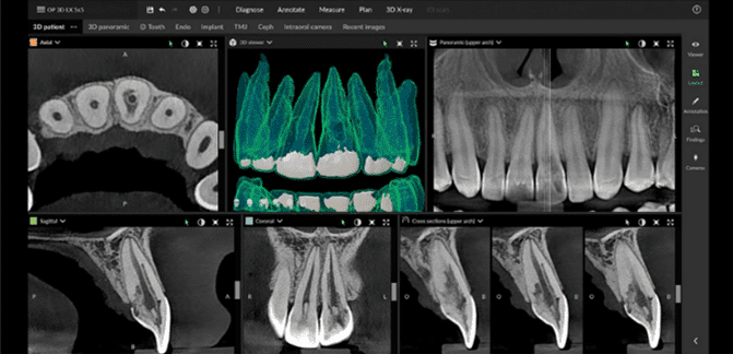 endodontie