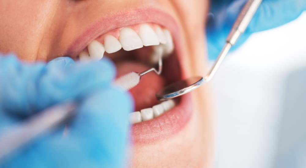 français consulte dentiste