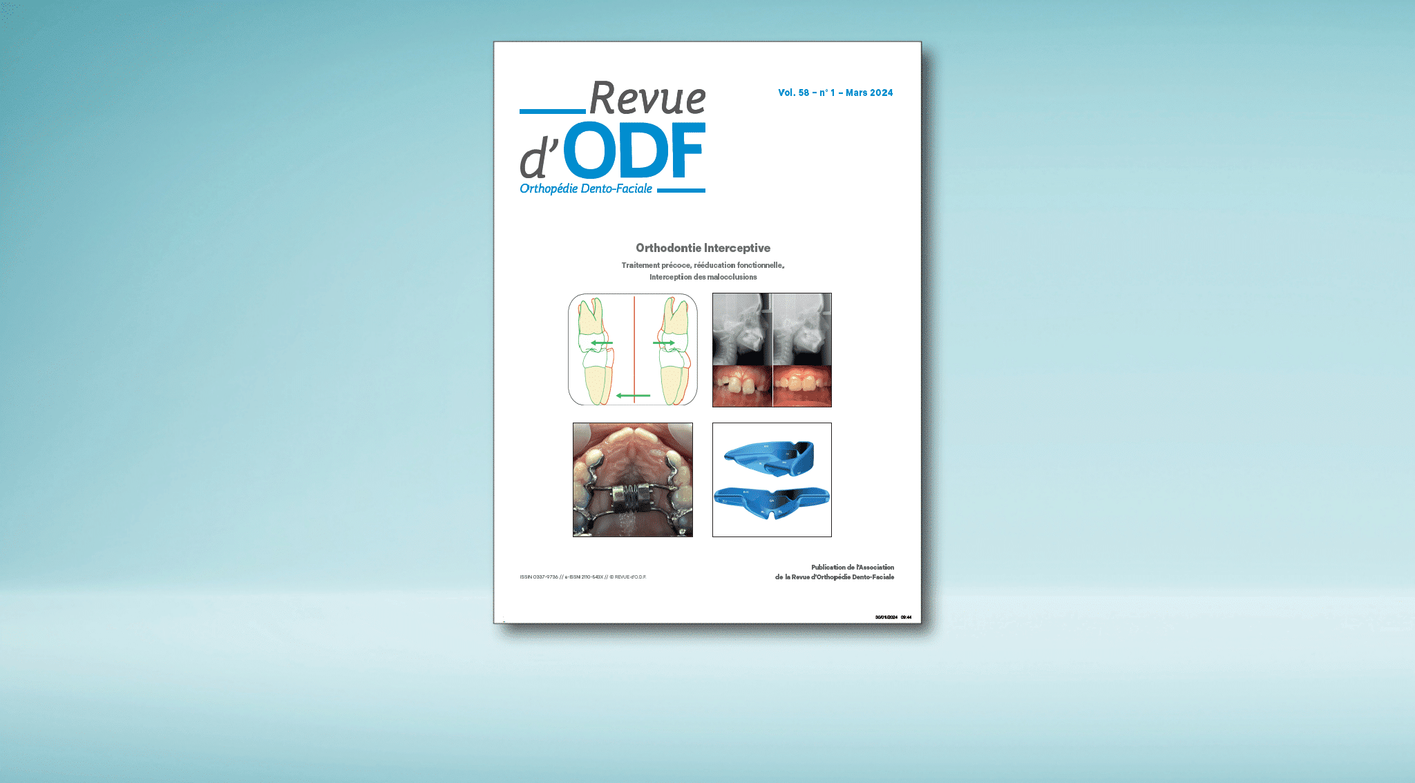 La Revue d’ODF – N°58-1 : Orthodontie Interceptive