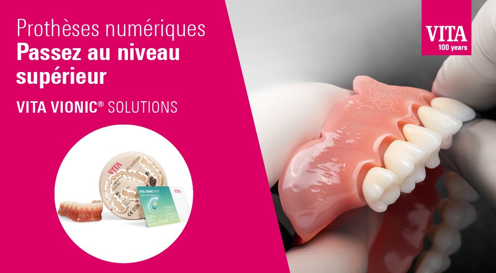 VITA VIONIC SOLUTIONS : passez au niveau supérieur pour votre prothèse amovible numérique VITA VIONIC SOLUTIONS : passez au niveau supérieur pour votre prothèse amovible numérique