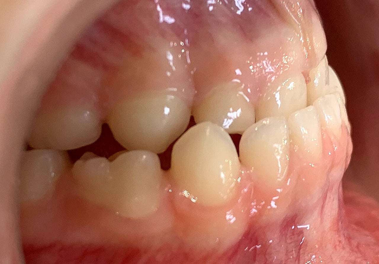 Orthodontie à l’usage du pédodontiste et du généraliste