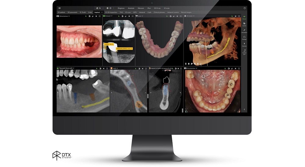 Logiciel DTX Studio Clinic