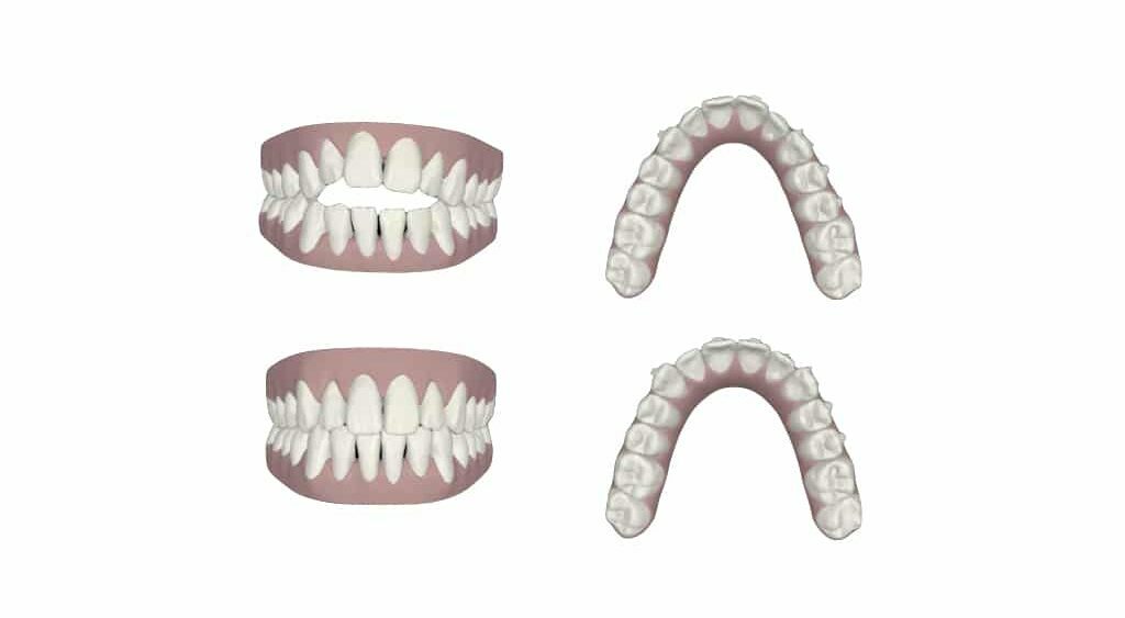 Esthétique et orthodontie