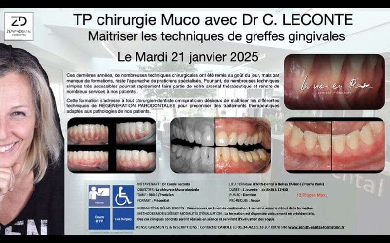 tp muco leconte