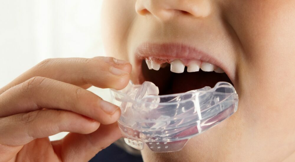 orthodontie fonctionnelle