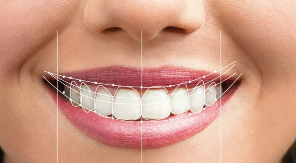 logiciels positionnement dents