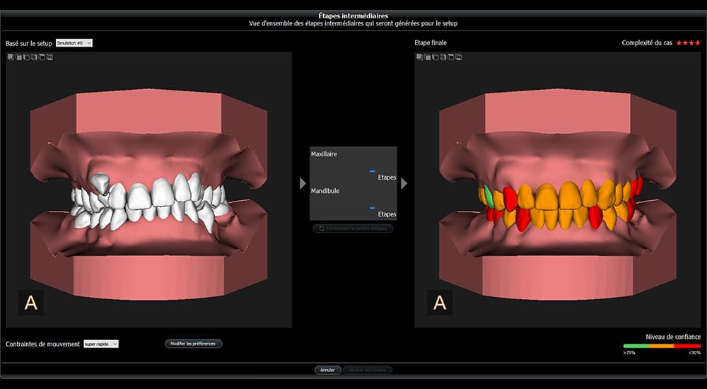 imagerie 3D intelligence artificielle