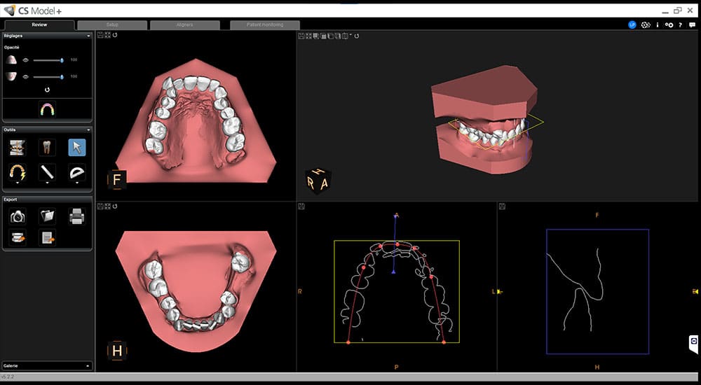 imagerie 3D intelligence artificielle