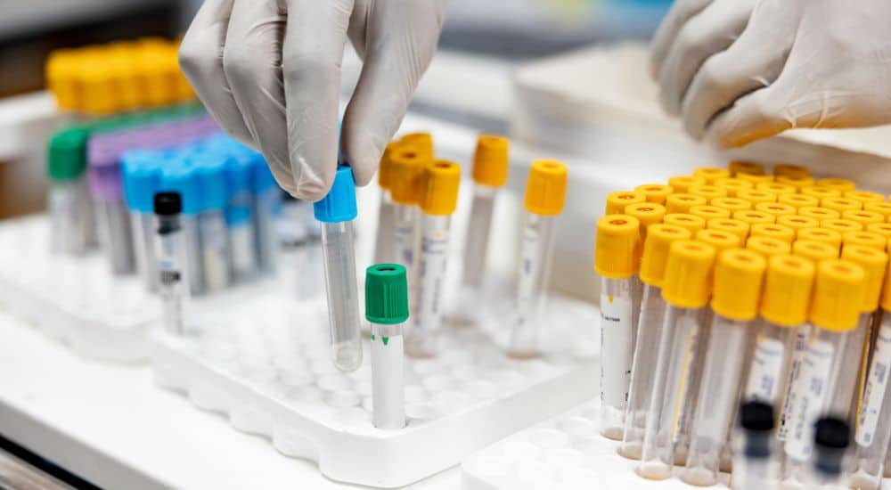 Gros plan sur des mains manipulant des échantillons de sang au laboratoire, biologie médicale