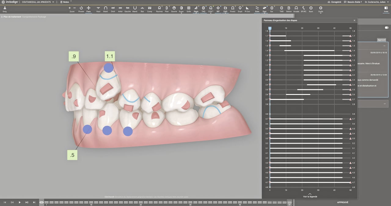 Fig.6 à 9 : Progression de la distalisation.