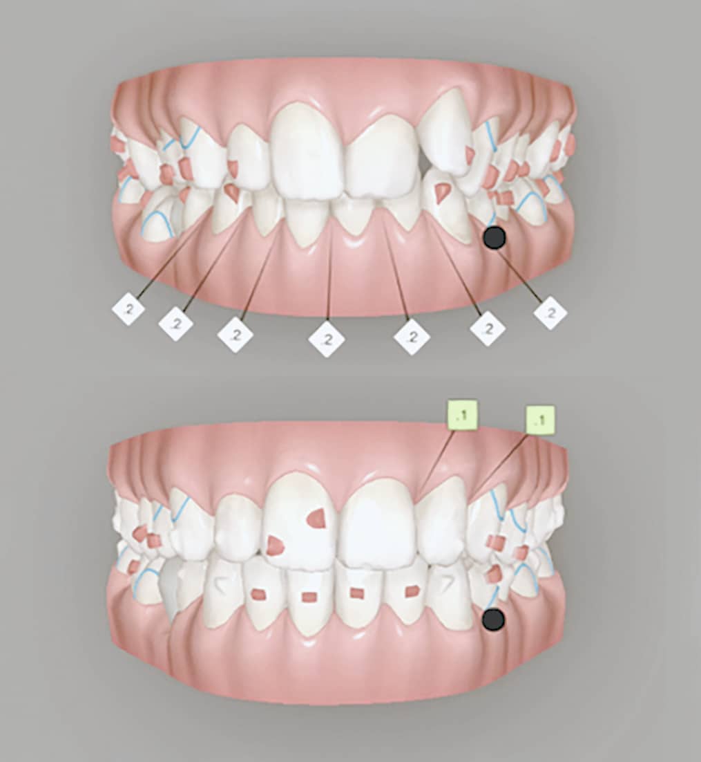 Fig.45 : Fin de la première série.