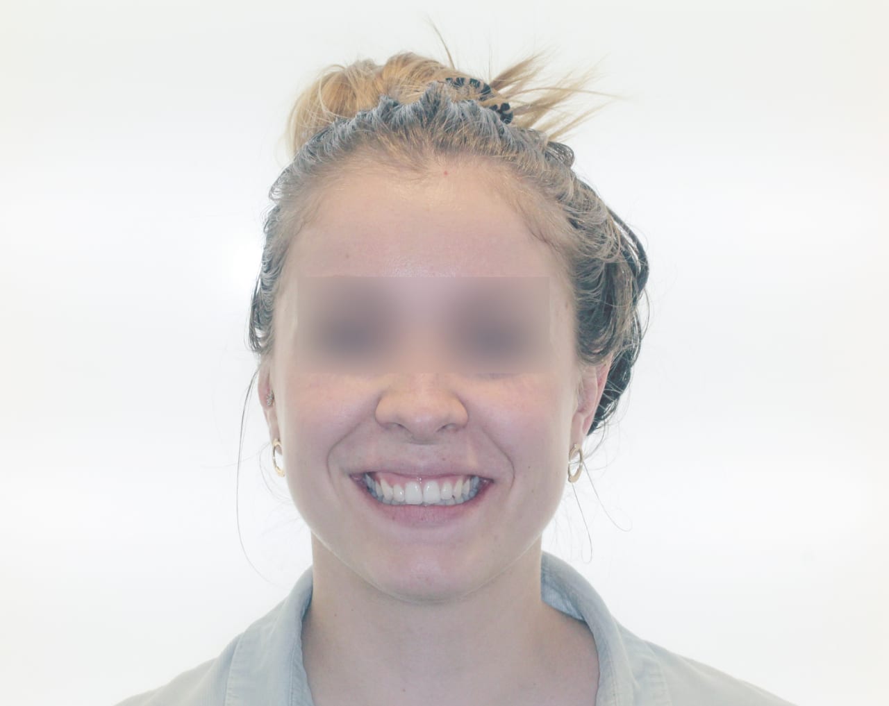 Fig.32 à 41 : Fin de traitement.