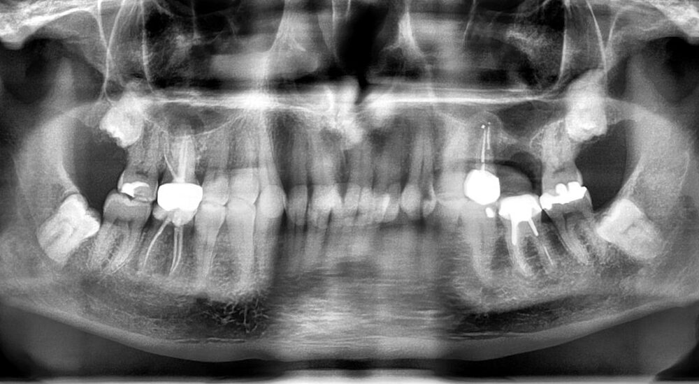 cbct en omnipratique