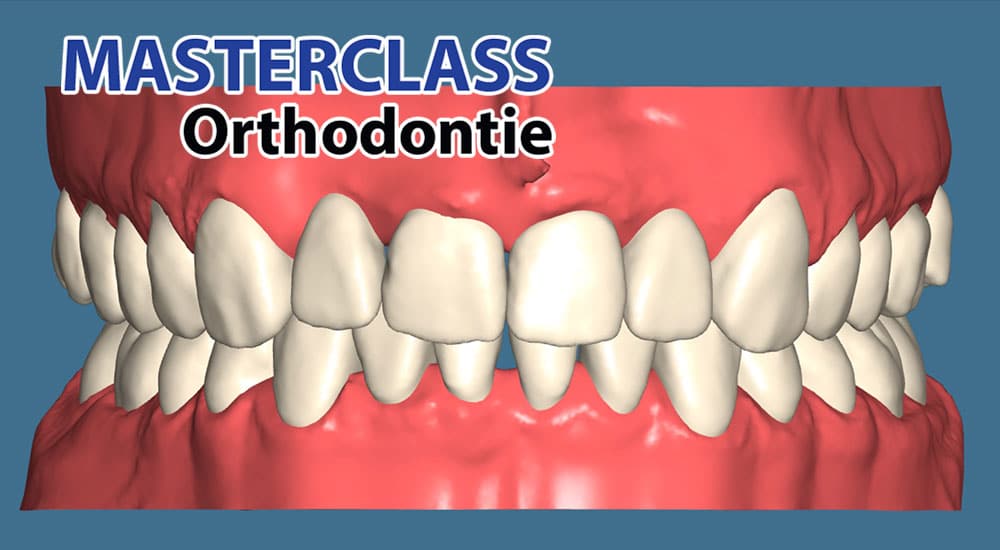 aligneurs au cabinet