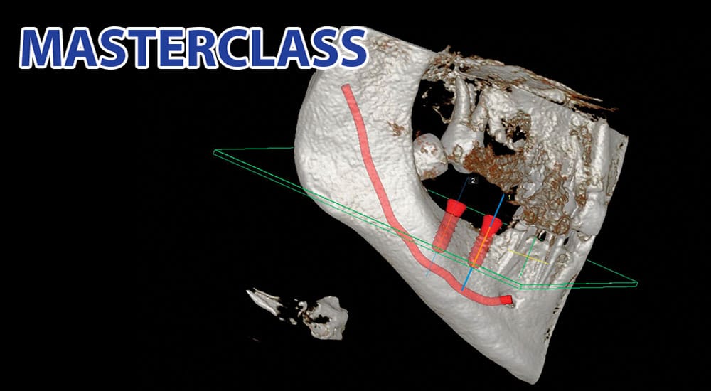 CBCT en omnipratique